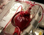 Is reanimating the heart from a recently dead human acceptable or ethical to save another life mit