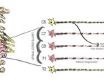 Rerouting nerves allows quadriplegic patients to feel and move their arms and hands