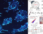 Any type of cancer accurately detected 96 percent of the time in one single drop of blood