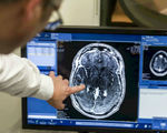 Video doctors finally break the blood brain barrier send drugs through using ultrasound waves
