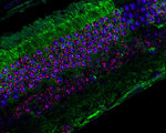 Hyper long telomeres without genetic editing delayed molecular ageing lower incidence cancer