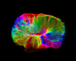 Cerebral organoid mini brain hue orientation neuroscience lancaster ior mar 19 1068x601