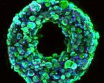 A swifter way towards 3d printed organs harvard