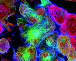 Breakthrough as scientists create a new cowpox style virus that can kill every type of cancer