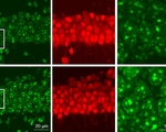 Mit aging neurons 0